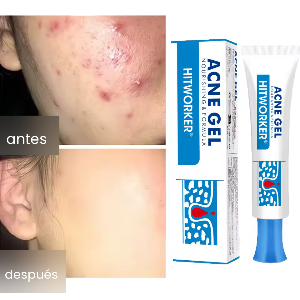 Avenza™ Gel Anti-Acné